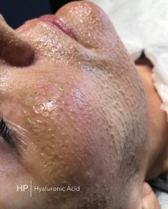 million dollar facial mask at Harmony Plus Beauty Salon & Skin Clinic near Leighton Buzzard