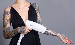 laser tattoo removal services near Aylesbury at Harmony Laser Lipo clinic