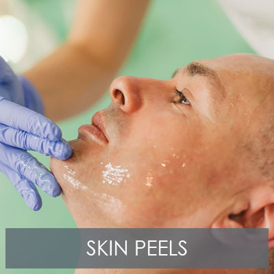 Skin Peels Skin Peels