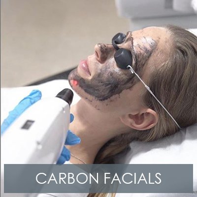 Carbon Laser Facials