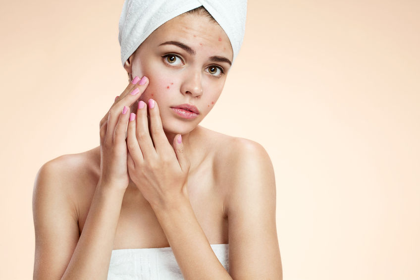 Acne Treatments at Top Dunstable Aesthetics Clinic