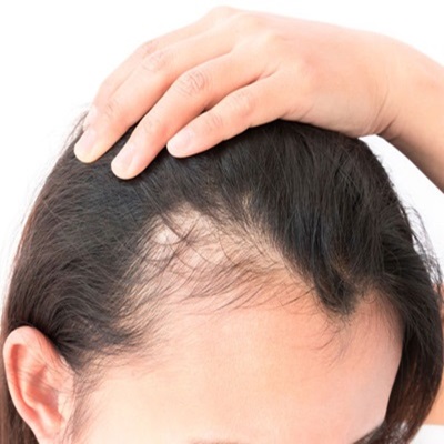 SCALP TATTOOING AT BEST BEAUTY SALON IN DUNSTABLE